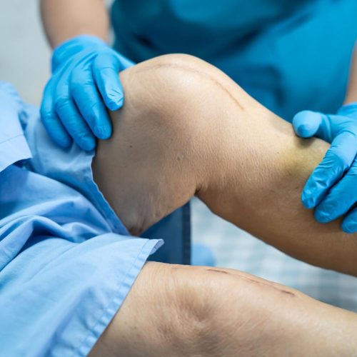Knee Surgery